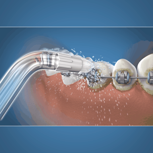 Waterpik ortodontinis antgalis OD